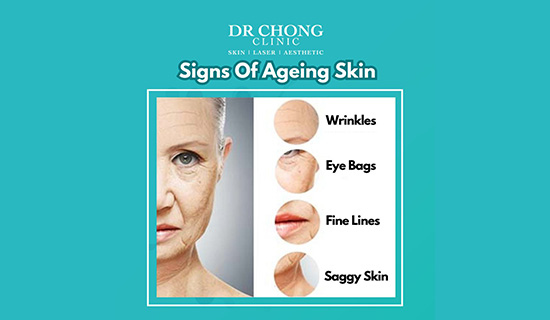 Read more about the article 4 signs of ageing skin: Wrinkles, Eye bags, fine lines soggy skin
